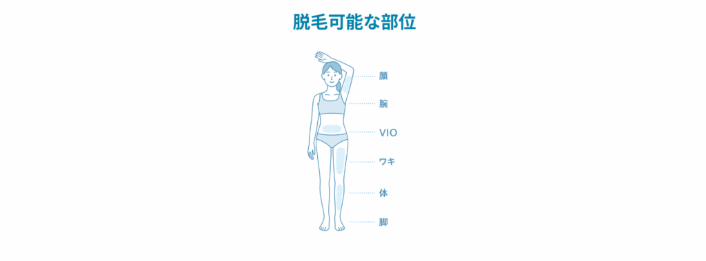 脱毛サロンciao脱毛可能な部位